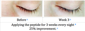 EyeLashes Serum Result