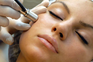 Microdermabrasion