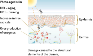 UV rays and photoaging diagram