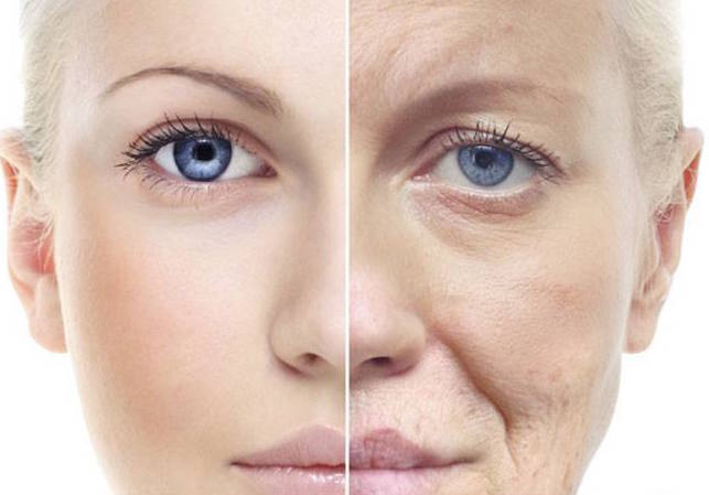 the effects of photoaging