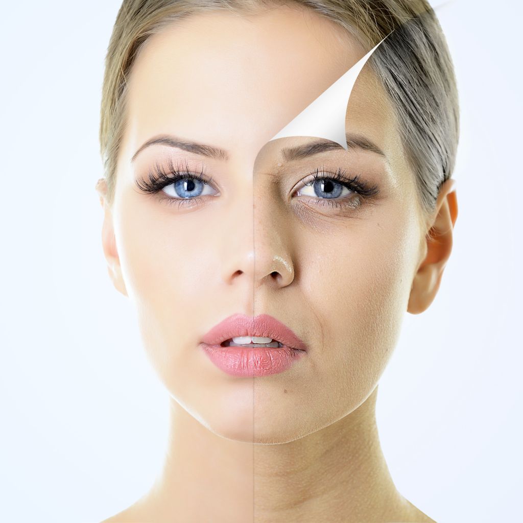 chemical peels treatments